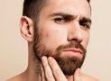 Barbe qui gratte : 7 causes et solutions pour y remédier