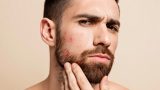 Barbe qui gratte : 7 causes et solutions pour y remédier