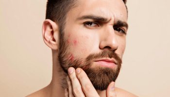 Barbe qui gratte : 7 causes et solutions pour y remédier