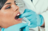 Le blanchiment dentaire avec gouttière : la technique pour retrouver un sourire radieux