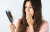 Perte de cheveux chez la femme : les causes qu&rsquo;on ignore souvent